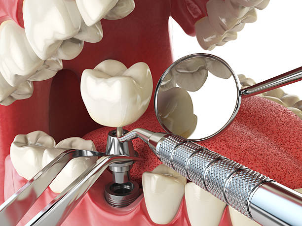 Best Emergency Denture Repair in South Cleveland, TN
