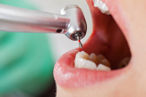 Best Emergency Dental Care for Sports Injuries in South Cleveland, TN
